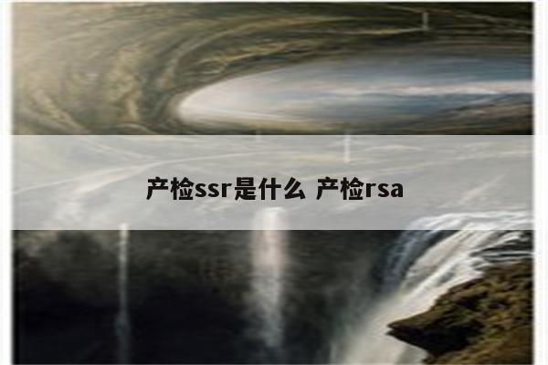 产检ssr是什么 产检rsa